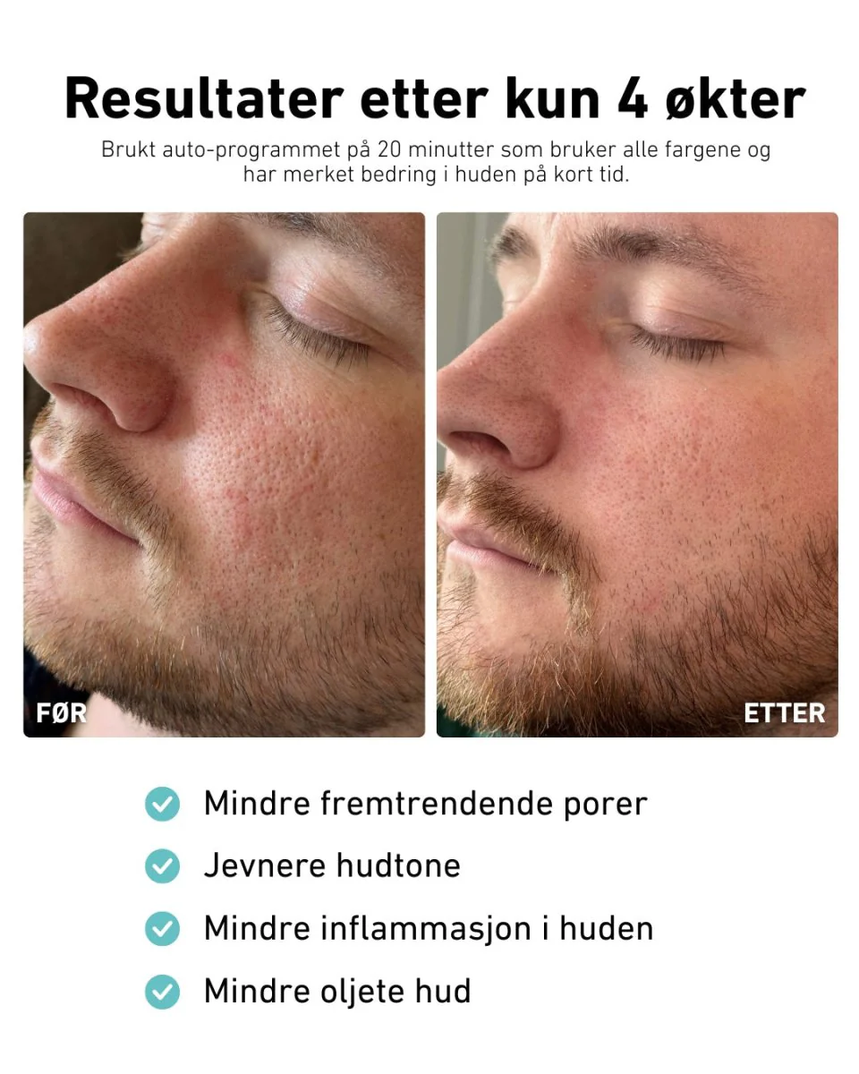Produktbilde 4