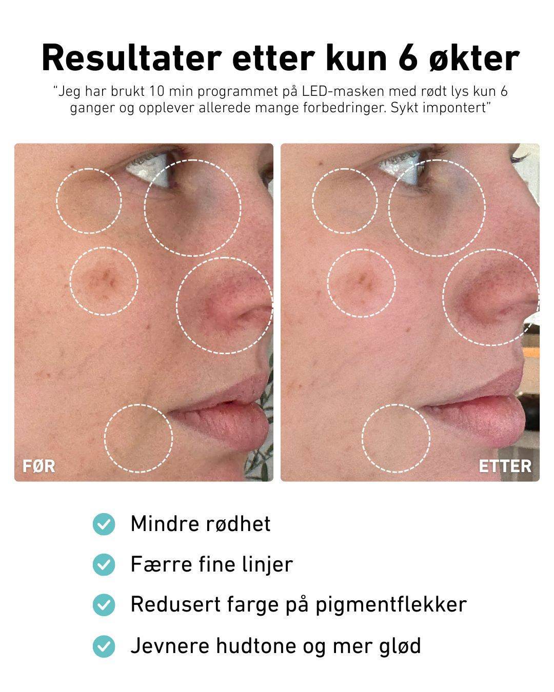 Produktbilde 5